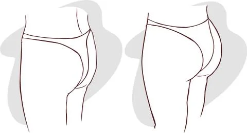 Green background Vector illustration of a buttocks implants Stock Illustration