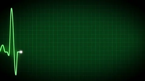 Green ECG graph Stock-Footage 48761692