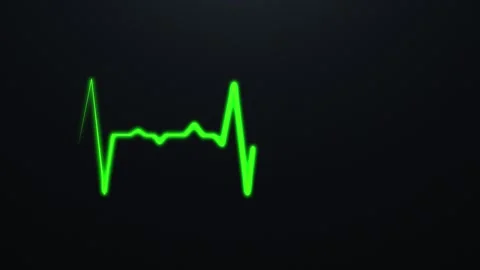 Green ECG heartbeat waveform glowing on dark background Stock Footage 328448920