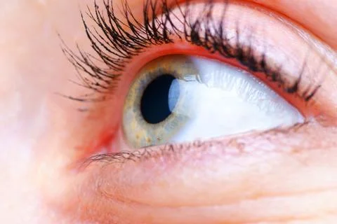 green eye