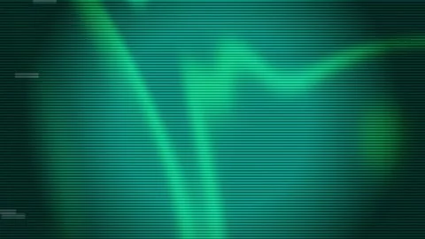Green Glitch Screen with Digital Noise and Scanlines Video stock 332708417
