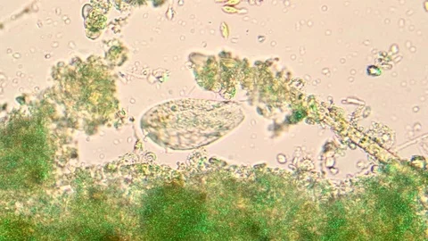 Green light of microscope showing a Paramecium near algae Stock Footage 87890316