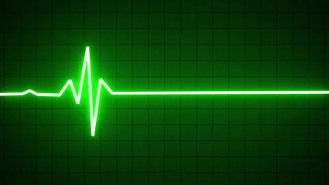 Green neon ECG pulse rate line. EKG pulse Wave, cardiogram and rhythm. Abst.. Stock Footage 295929464