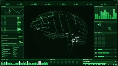Green neuroscience HUD interface with a particle brain scan EEG traces region Vídeo Stock 344792897