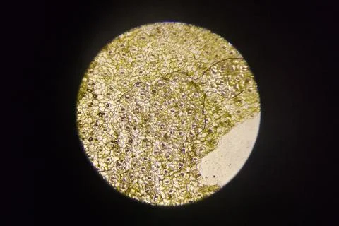 Green Plant Cells Under Microscope. Chloroplasts in Plant Cells. Stock Photos