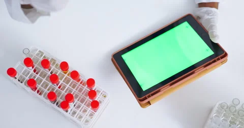 Green screen tablet, science and hands with blood, sample research and medical Stock Footage 242023547