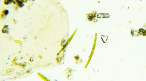 Green String-Cells Floating in Cytoplasm Stock-Footage 65024016