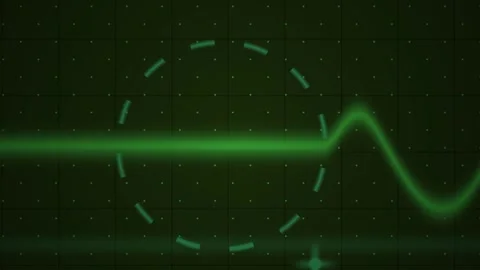 Green Waveform Moving on Grid Screen Showing Electronic Signal Pulse Stock Footage 343723668