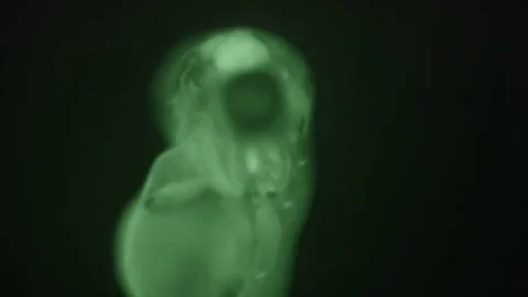 GreenFishEmbryo Stock Footage 78578297