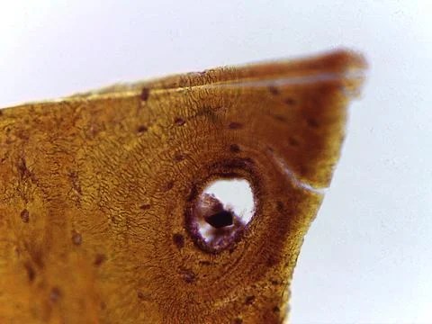 Ground Section Micrograph of Human Compact Bone Tissue Highlighting the Hav.. 스톡 사진
