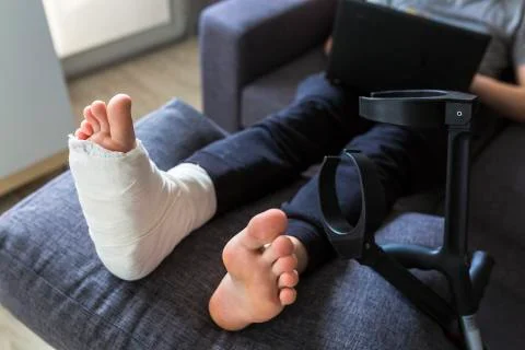 Grounded at home with a leg in a cast Stock Photos