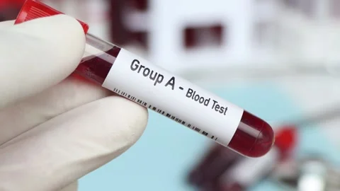 Group A - Blood Test, blood sample to analyze in the laboratory Stock Footage 239507879