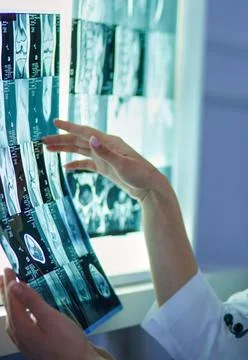 Group of doctors examining x-rays in a clinic, thinking of a diagnosis Stock Photos
