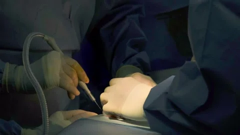 A group of professional mixed race surgeons in uniform performing Stock Footage 270467372