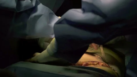 A group of professional mixed race surgeons in uniform performing Stock Footage 270469586