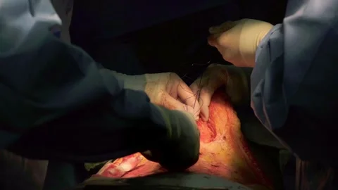 A group of professional mixed race surgeons in uniform performing Stock Footage 270469587