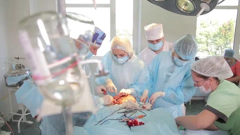 A group of surgeons perform an operation. near the operating table. patient Video stock 76023486