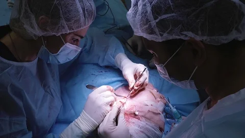 A group of surgeons performs a facelift operation. Ear scalpel incision Stock Footage 124402346