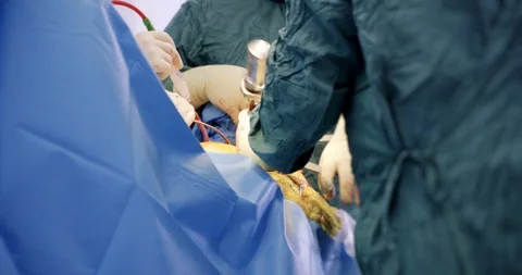 A group of surgeons at work. Closeup of operation. Medicine, surgery, health Video stock 121095409