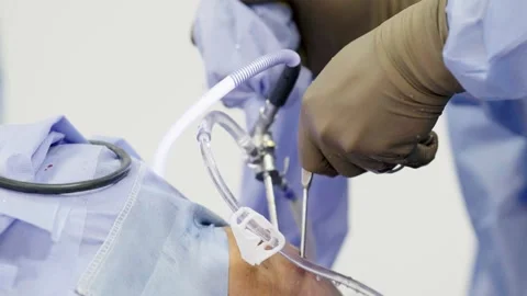 A group of surgeons works in the operating room. Stockbeeldmateriaal 269443764