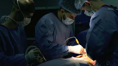 A group of surgeons works in the operating room. Stock Footage 270466220