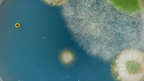 Growing Bacterial Colonies In Petri Dish, Time Lapse Stock Footage 106901366
