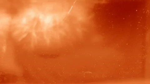 Growing Fibroid  库存影片 285700