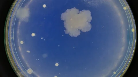 Growth of bacteria in a petri dish samples taken in the trading floor of the Stock Footage 210881566