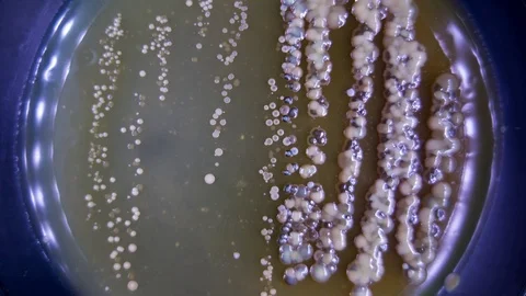 Growth Colony of microbes and pathogenic fungi in petri dish Stock Footage 74669954