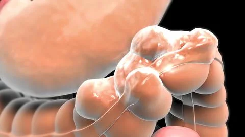 The growth that develops inside the colon is the name given to the colons. Stock Illustration