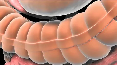 The growth that develops inside the colon is the name given to the colons. Stock Illustration