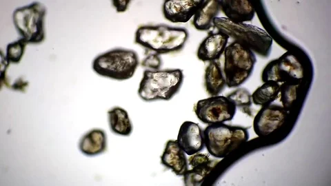 Growth Of Microbes Or Germs Under The Microscope Stock Footage 124208808