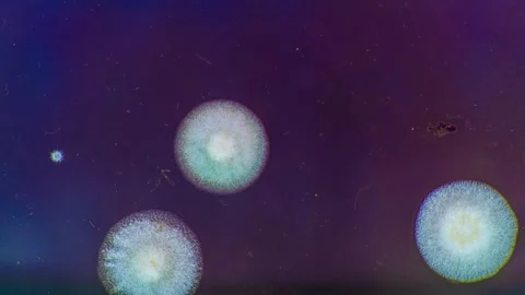 Growth of microbial colonies on a nutrient medium for 5 days. Time lapse Stock Footage 130283643