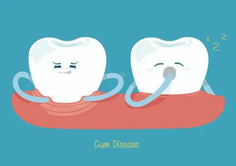 Gum disease Stock Illustration