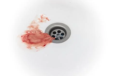 Gums bleed when brush the teeth and blood in toothpaste foam on white sink Stock Photos