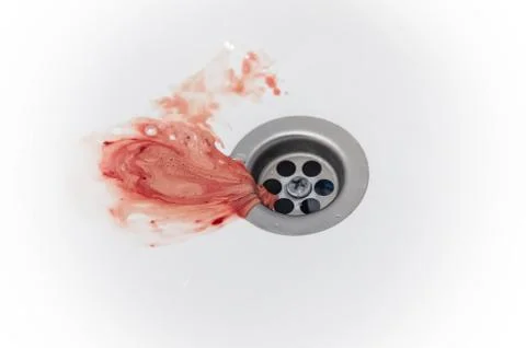 Gums bleed when brush the teeth and blood in toothpaste foam on white sink 库存照片