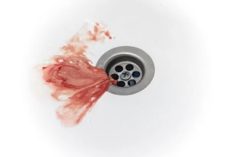 Gums bleed when brush the teeth and blood in toothpaste foam on white sink Stock Photos
