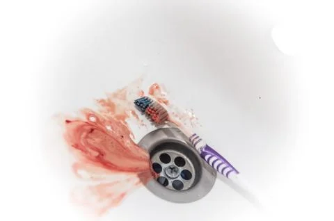 Gums bleed when brush the teeth and blood in toothpaste foam on white sink Stock Photos