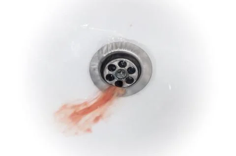 Gums bleed when brush the teeth and blood in toothpaste foam on white sink Stock Photos