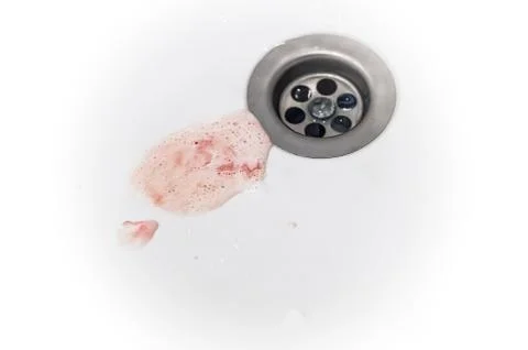 Gums bleed when brush the teeth and blood in toothpaste foam on white sink Stock Photos
