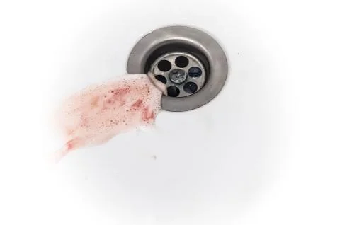 Gums bleed when brush the teeth and blood in toothpaste foam on white sink Stock Photos