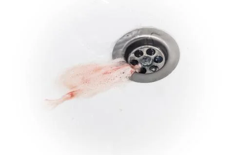 Gums bleed when brush the teeth and blood in toothpaste foam on white sink Stock Photos