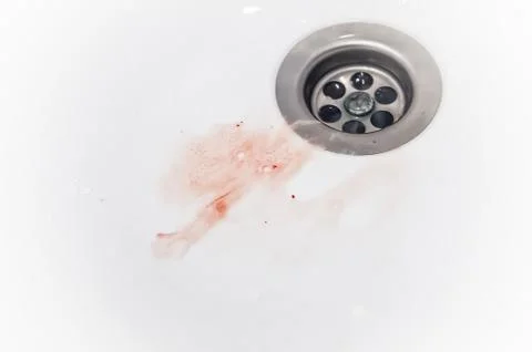 Gums bleed when brush the teeth and blood in toothpaste foam on white sink Stock Photos