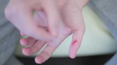 Guy gloves the wound on his finger plaster Stock Footage 61455623