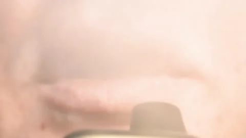 A guy with problem skin smokes a vape and hovers at the camera close-up. Stock Footage 268651618