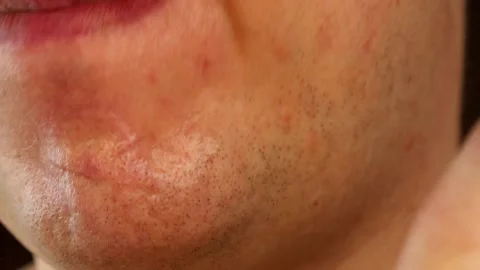 The guy shaves one side of his face. Hygiene facial care Stock Footage 172124994