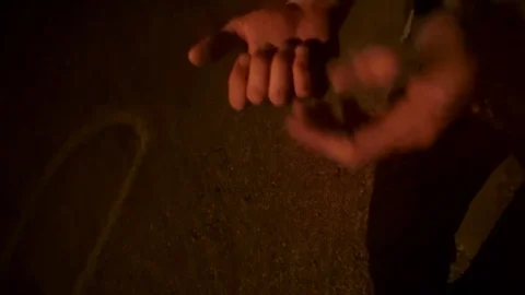 Guy shows fall damage Video stock 103044697