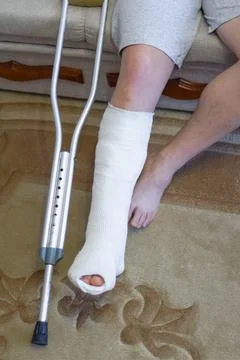 The guy is sitting on the couch in a cast. Broken leg Foto stock