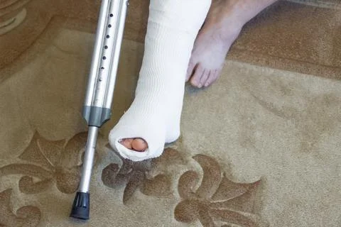 The guy is sitting on the couch in a cast. Broken leg Foto stock