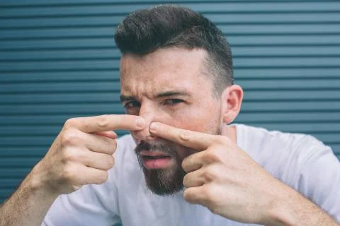 Guy is squeezing pimples on his nose. He is looking close on camera. Isolated Stockfoto's